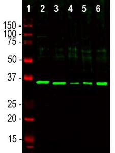 Western blot analysis of different cell lysates using Anti-Fibrillarin Antibody (1:5,000 / green): [1] protein standard (red), [2] NIH-3T3, [3] HEK293, [4] HeLa, [5] SH-SY5Y, and [6] C6 cells. The single strong band at ~35kDa corresponds to the fibrillarin protein.