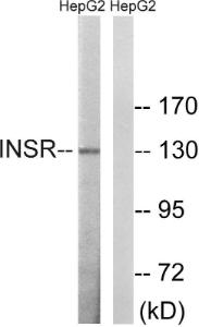 Anti-Insulin Receptor beta Rabbit Polyclonal Antibody