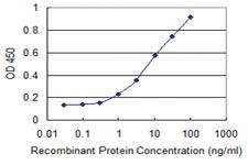 Anti-IKBKB Mouse Monoclonal Antibody [clone: 1A3]