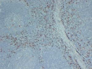 Immunohistochemical analysis of paraffin-embedded human Tonsil using Anti-CD163 Antibody