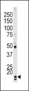 Anti-H3F3AP6 Rabbit Polyclonal Antibody (AP (Alkaline Phosphatase))