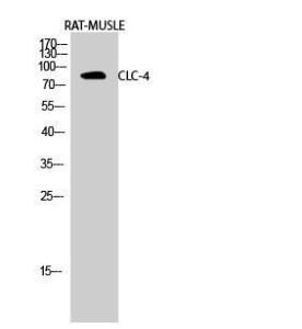 Western blot analysis of rat MUSLE cells using Anti-CLCN4 Antibody