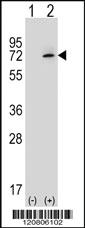 Anti-XRCC6 Rabbit Polyclonal Antibody