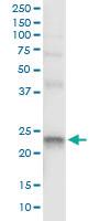 Anti-LITAF Polyclonal Antibody Pair