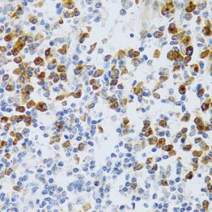 Immunohistochemistry analysis of paraffin-embedded human tonsil using Anti-p60 CAF1/MPP7 Antibody (A11945) at a dilution of 1:100 (40x lens) Perform microwave antigen retrieval with 10 mM PBS buffer pH 72 before commencing with IHC staining protocol