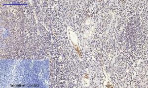 Immunohistochemical analysis of paraffin-embedded human Tonsil tissue using Anti-GLUT1 Antibody at 1:200 (4 °C overnight). Negative control was secondary Antibody only