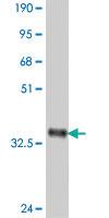 Anti-FZD4 Mouse Polyclonal Antibody