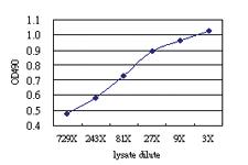 Anti-TOP3B Antibody Pair