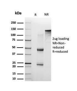 SDS-PAGE analysis of Anti-NF-kB p65 Antibody [PCRP-RELA-1E3] under non-reduced and reduced conditions; showing intact IgG and intact heavy and light chains, respectively. SDS-PAGE analysis confirms the integrity and purity of the Antibody