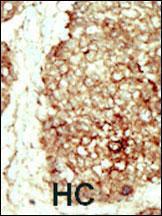 Anti-FGFR2 Rabbit Polyclonal Antibody (Biotin)