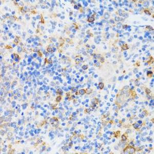 Immunohistochemistry analysis of paraffin-embedded mouse spleen using Anti-p60 CAF1/MPP7 Antibody (A11945) at a dilution of 1:100 (40x lens) Perform microwave antigen retrieval with 10 mM PBS buffer pH 72 before commencing with IHC staining protocol