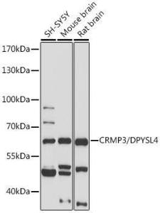 Western blot analysis of extracts of various cell lines, using Anti-CRMP3 Antibody (A305573) at 1:1,000 dilution