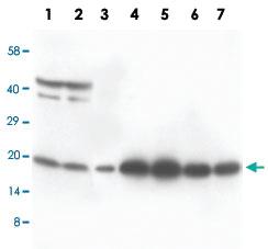 Anti-S100 B Rabbit Polyclonal Antibody