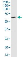 Anti-MCCC2 Rabbit Polyclonal Antibody