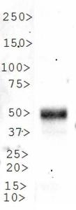 Anti-MMP7 Rabbit Polyclonal Antibody (DyLight® 488)