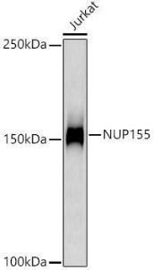 Western blot analysis of extracts of Jurkat cells, using Anti-NUP155 Antibody [ARC3030] (A309430) at 1:1000 dilution