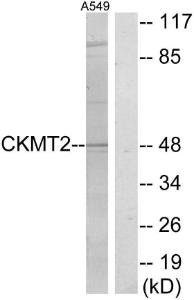 Western blot analysis of lysates from A549 cells using Anti-CKMT2 Antibody. The right hand lane represents a negative control, where the antibody is blocked by the immunising peptide