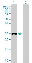 Anti-RPIA Mouse Polyclonal Antibody