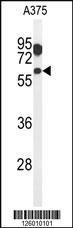 Anti-ZACN Rabbit Polyclonal Antibody