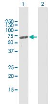 Anti-MCCC2 Rabbit Polyclonal Antibody