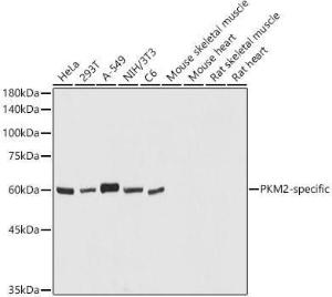 Western blot analysis of extracts of various cell lines, using Anti-PKM Antibody (A306602) at 1:1,000 dilution The secondary antibody was Goat Anti-Rabbit IgG H&L Antibody (HRP) at 1:10,000 dilution Lysates/proteins were present at 25 µg per lane