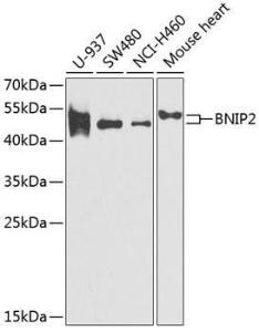 Western blot analysis of extracts of various cell lines, using Anti-BNIP2 Antibody (A11948) at 1:1000 dilution