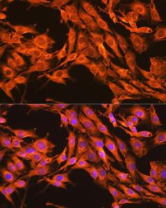 Immunofluorescence analysis of C6 cells using Anti-PKM Antibody (A306602) at a dilution of 1:100 (40x lens) DAPI was used to stain the cell nuclei (blue)