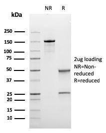 Anti-Bcl-6 antibody