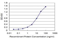 Anti-IKBKB Mouse Monoclonal Antibody [clone: 3C12]