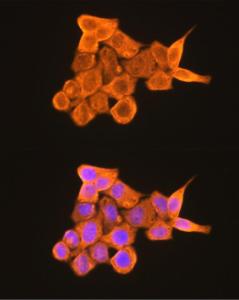 Immunofluorescence analysis of HeLa cells using Anti-PKM Antibody (A306602) at a dilution of 1:100 (40x lens) DAPI was used to stain the cell nuclei (blue)