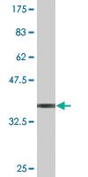 Anti-FZD4 Mouse Monoclonal Antibody [clone: 3G7]