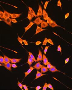 Immunofluorescence analysis of NIH-3T3 cells using Anti-PKM Antibody (A306602) at a dilution of 1:100 (40x lens) DAPI was used to stain the cell nuclei (blue)