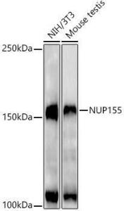 Western blot analysis of extracts of various cell lines, using Anti-NUP155 Antibody [ARC3030] (A309430) at 1:1000 dilution