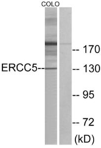 Anti-XPG Rabbit Polyclonal Antibody