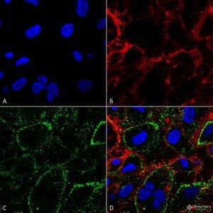 Anti-HSP70 antibody