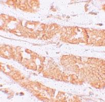 Anti-HMMR Rabbit Polyclonal Antibody