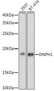 Western blot analysis of extracts of various cell lines, using Anti-RCL Antibody [ARC2571] (A306605) at 1:1,000 dilution