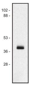 Anti-HLA Class I Mouse Monoclonal Antibody [Clone: MEM-147]