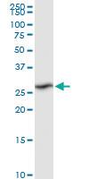 Anti-RPIA Rabbit Polyclonal Antibody