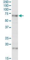 Anti-MCCC2 Rabbit Polyclonal Antibody