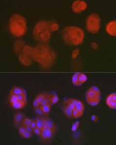 Immunofluorescence analysis of MCF7 cells using Anti-RCL Antibody [ARC2571] (A306605) at a dilution of 1:50 (40X lens). DAPI was used to stain the cell nuclei (blue)