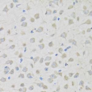 Anti-Enkephalin/ENK Rabbit Polyclonal Antibody