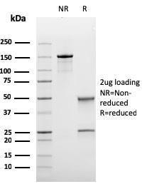 SDS-PAGE analysis of Anti-Bcl-6 Antibody [rBCL6/1475] under non-reduced and reduced conditions; showing intact IgG and intact heavy and light chains, respectively. SDS-PAGE analysis confirms the integrity and purity of the Antibody