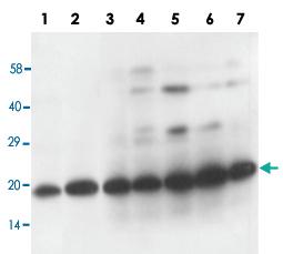 Anti-TFPI2 Rabbit Polyclonal Antibody