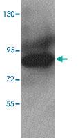 Anti-HMMR Rabbit Polyclonal Antibody