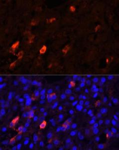 Anti-Enkephalin/ENK Rabbit Polyclonal Antibody