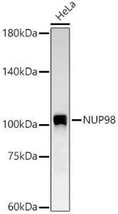 Western blot analysis of HeLa, using Anti-NUP98 Antibody [ARC58955] (A309431) at 1:6,000 dilution. The secondary antibody was Goat Anti-Rabbit IgG H&L Antibody (HRP) at 1:10,000 dilution.