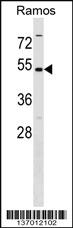 Anti-MAT2A Rabbit Polyclonal Antibody