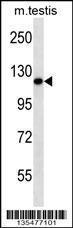 Anti-ERN2 Rabbit Polyclonal Antibody (PE (Phycoerythrin))