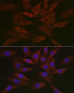 Immunofluorescence analysis of NIH/3T3 cells using Anti-RCL Antibody [ARC2571] (A306605) at a dilution of 1:50 (40X lens). DAPI was used to stain the cell nuclei (blue)